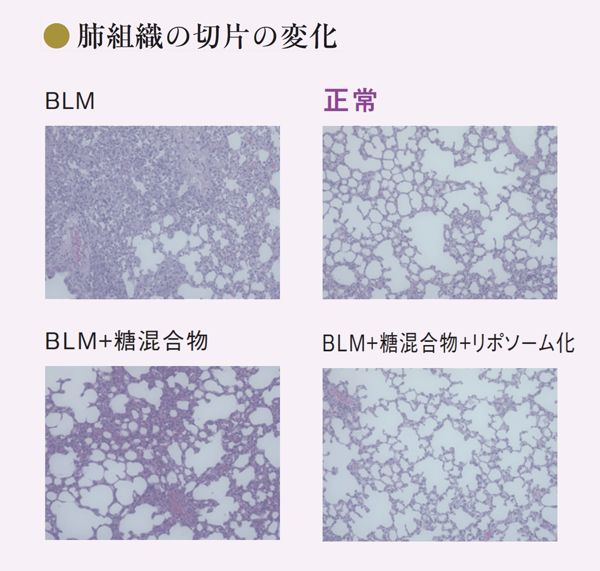 肺組織の切片の変化